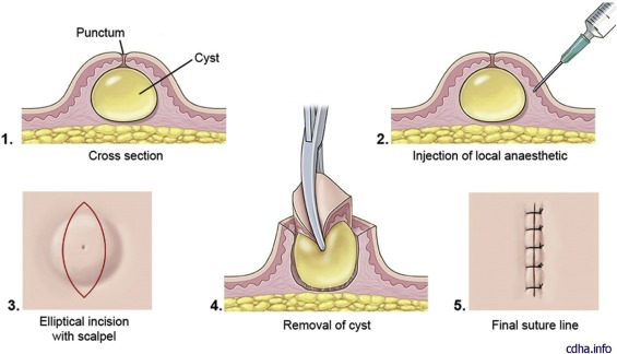 overview https://www.sciencedirect.com/science/article/pii/S2352047719300401